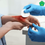 Panduan Dasar Perawatan Luka yang Aman dan Steril