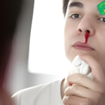 Apa yang Harus Dilakukan Saat Mimisan? Ini Langkah yang Tepat