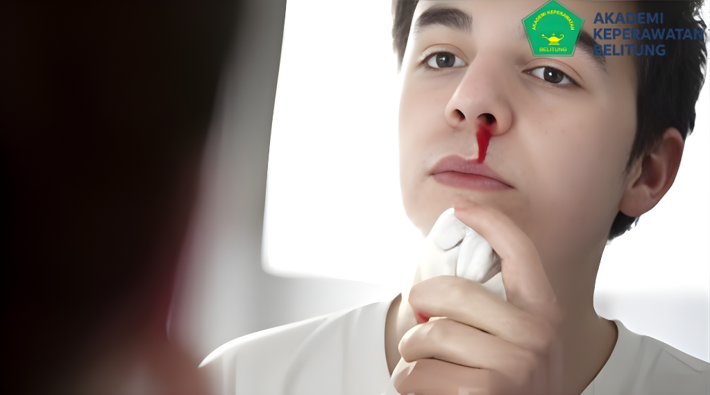 Apa yang Harus Dilakukan Saat Mimisan? Ini Langkah yang Tepat