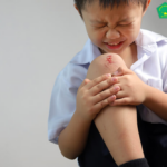 Tips Merawat Luka Ringan agar Cepat Sembuh