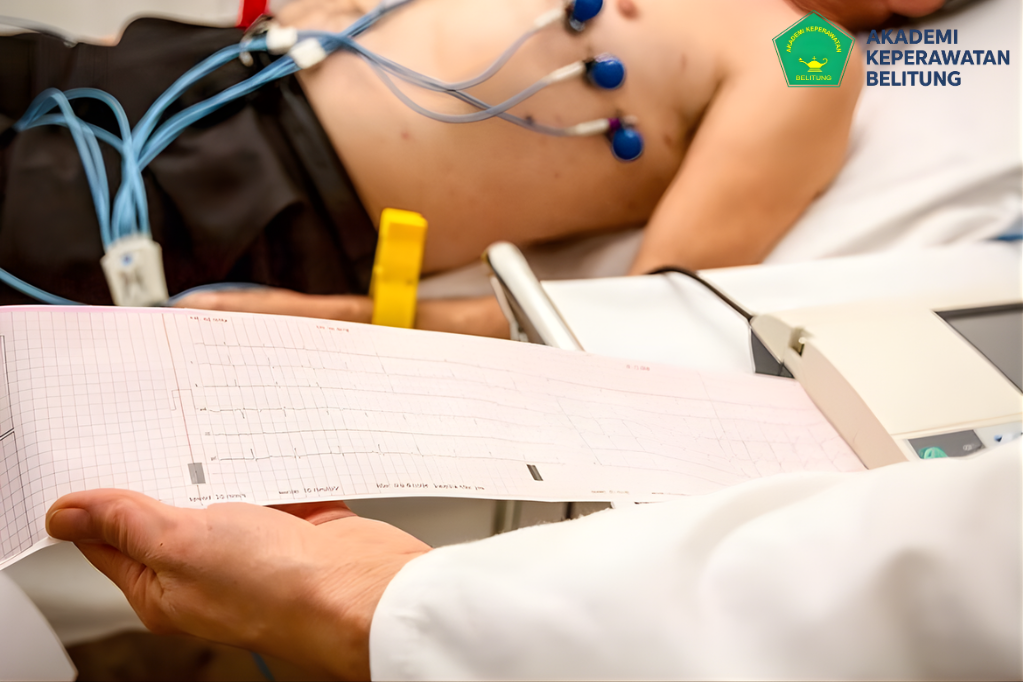 Membaca EKG Perawat: Cara Membaca EKG Sederhana untuk Perawat Pemula