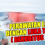 Perawatan Luka Tekan Derajat 3 dan 4: Panduan Langkah Demi Langkah